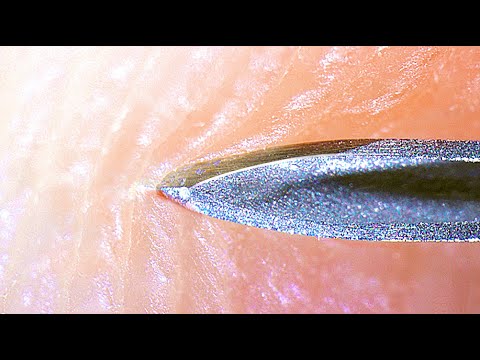 NEEDLE IN TO HUMAN SKIN - [under microscope]