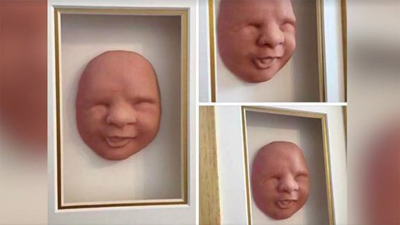 Kindermaske vom ungeborenen Kind aus dem 3D Drucker